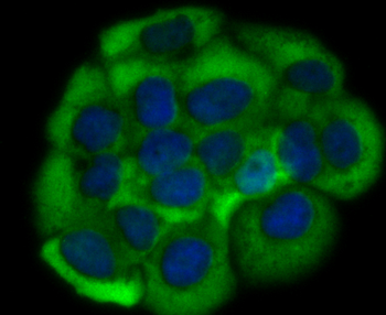 Growth hormone receptor Recombinant Rabbit Monoclonal Antibody