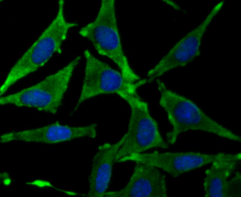 Growth hormone receptor Recombinant Rabbit Monoclonal Antibody