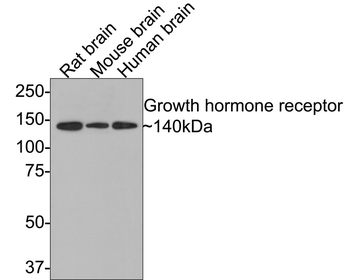 Growth hormone receptor Recombinant Rabbit Monoclonal Antibody
