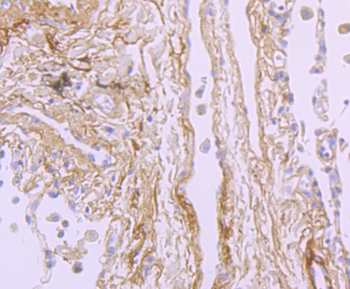 TGFBI Recombinant Rabbit Monoclonal Antibody