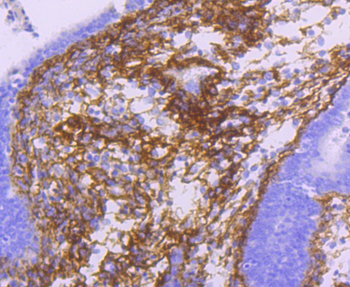 TGFBI Recombinant Rabbit Monoclonal Antibody