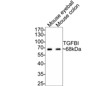 TGFBI Recombinant Rabbit Monoclonal Antibody