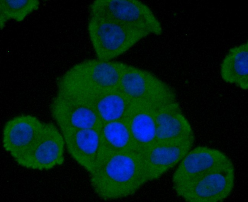 CFH Recombinant Rabbit Monoclonal Antibody