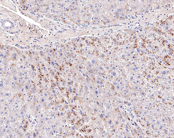CFH Recombinant Rabbit Monoclonal Antibody