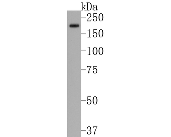 CFH Recombinant Rabbit Monoclonal Antibody