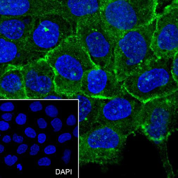 ADRB2 Recombinant Rabbit Monoclonal Antibody