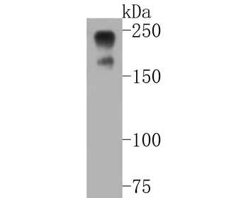 NF-H Recombinant Rabbit Monoclonal Antibody