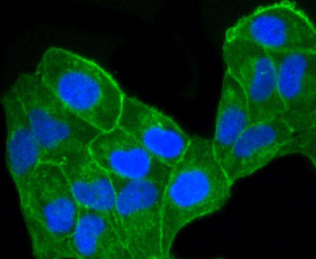 CCR7 Recombinant Rabbit Monoclonal Antibody
