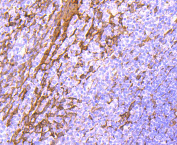 Hsp27 Recombinant Rabbit Monoclonal Antibody