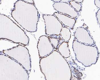 PAX8 Recombinant Rabbit Monoclonal Antibody