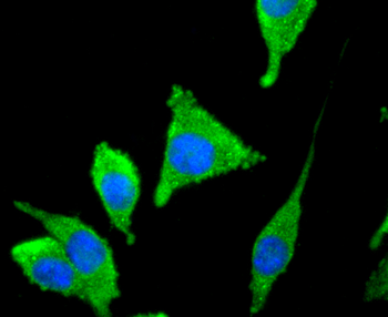 Tyrosine Hydroxylase Recombinant Rabbit Monoclonal Antibody