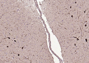 Tyrosine Hydroxylase Recombinant Rabbit Monoclonal Antibody