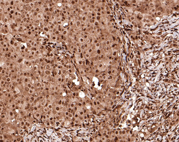 HES1 Recombinant Rabbit Monoclonal Antibody