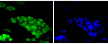 TCF7L2 Recombinant Rabbit Monoclonal Antibody