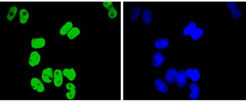 TCF7L2 Recombinant Rabbit Monoclonal Antibody