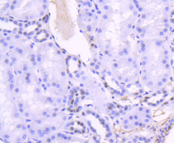 TCF7L2 Recombinant Rabbit Monoclonal Antibody