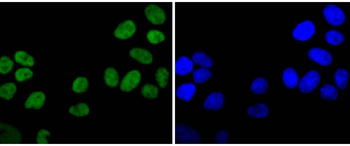 Ku80 Recombinant Rabbit Monoclonal Antibody