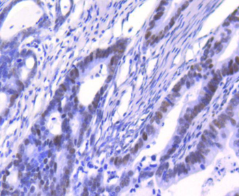 Ku80 Recombinant Rabbit Monoclonal Antibody