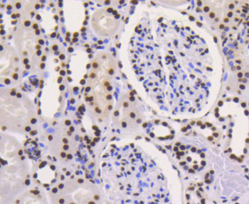 Ku80 Recombinant Rabbit Monoclonal Antibody