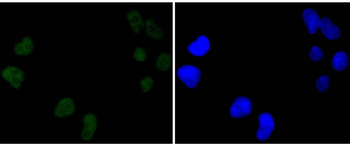 DNA PKcs Recombinant Rabbit Monoclonal Antibody