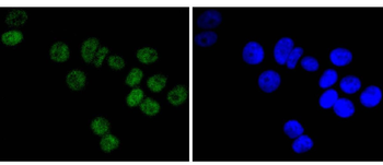 DNA PKcs Recombinant Rabbit Monoclonal Antibody