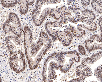 DNA PKcs Recombinant Rabbit Monoclonal Antibody