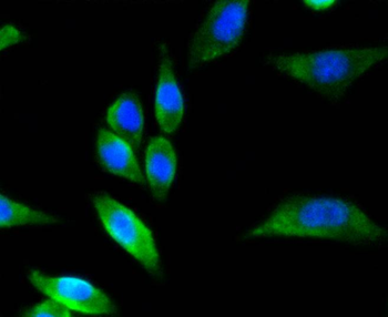 NNOS Recombinant Rabbit Monoclonal Antibody