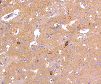 NNOS Recombinant Rabbit Monoclonal Antibody
