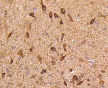 NNOS Recombinant Rabbit Monoclonal Antibody