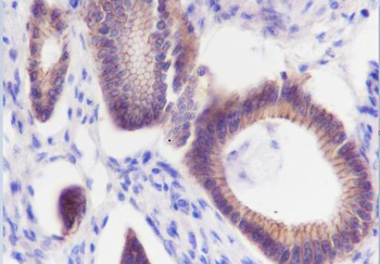 N Cadherin Recombinant Rabbit Monoclonal Antibody