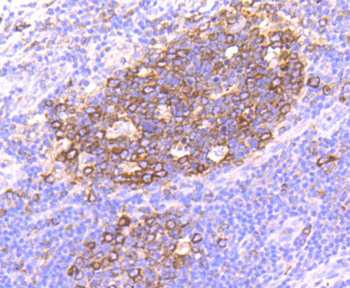 Hsp90 alpha Recombinant Rabbit Monoclonal Antibody