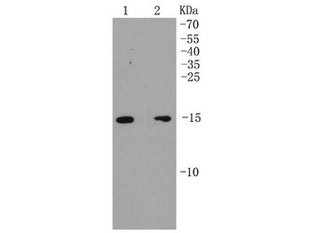 ARPC5 Recombinant Rabbit Monoclonal Antibody