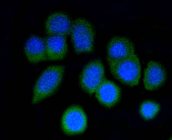 ARPC5 Recombinant Rabbit Monoclonal Antibody