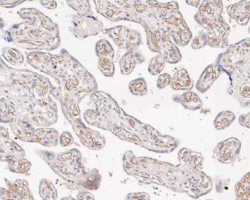 ARPC5 Recombinant Rabbit Monoclonal Antibody