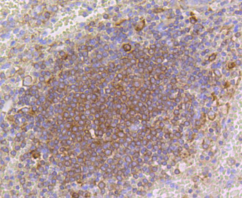ARPC5 Recombinant Rabbit Monoclonal Antibody