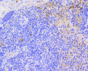 ARPC5 Recombinant Rabbit Monoclonal Antibody