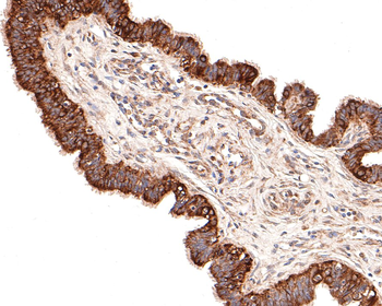 Beta Tubulin Recombinant Rabbit Monoclonal Antibody