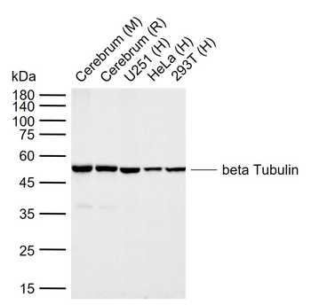 Beta Tubulin Recombinant Rabbit Monoclonal Antibody
