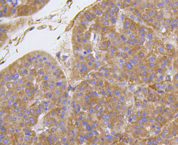Integrin beta 1 Recombinant Rabbit Monoclonal Antibody