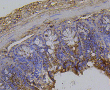 Integrin beta 1 Recombinant Rabbit Monoclonal Antibody