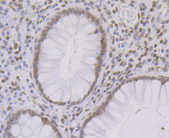 SUN2 Recombinant Rabbit Monoclonal Antibody