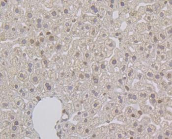 SUN2 Recombinant Rabbit Monoclonal Antibody