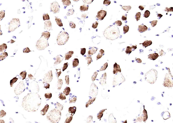 Desmin Mouse Monoclonal Antibody