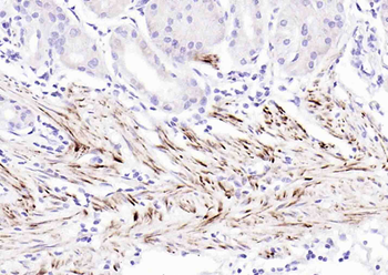 Desmin Mouse Monoclonal Antibody