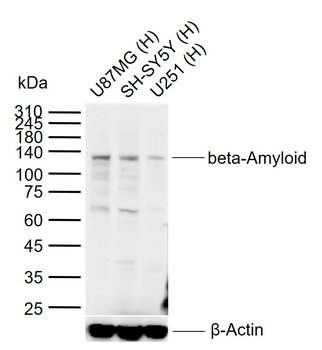 Beta-Amyloid (1-40) Mouse Monoclonal Antibody