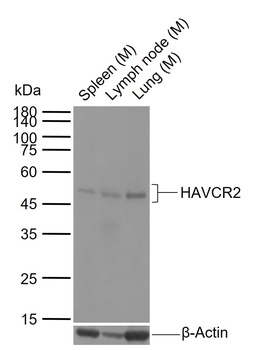 HAVCR2/TIM-3 Rabbit Polyclonal Antibody