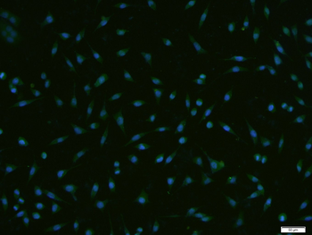 RPS6KA1 Rabbit Polyclonal Antibody