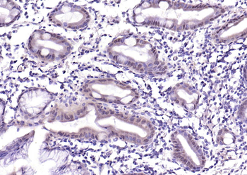 ASC/TMS1 Rabbit Polyclonal Antibody