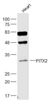 PITX2 Rabbit Polyclonal Antibody
