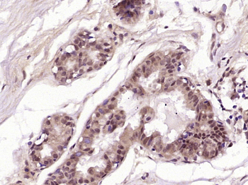 PIBF1 Rabbit Polyclonal Antibody